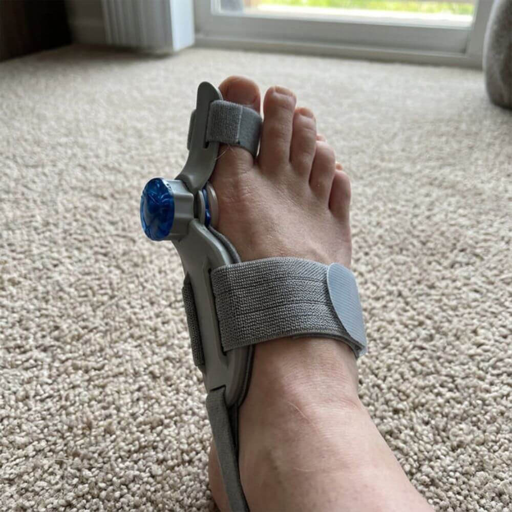 3D Bunion Corrector