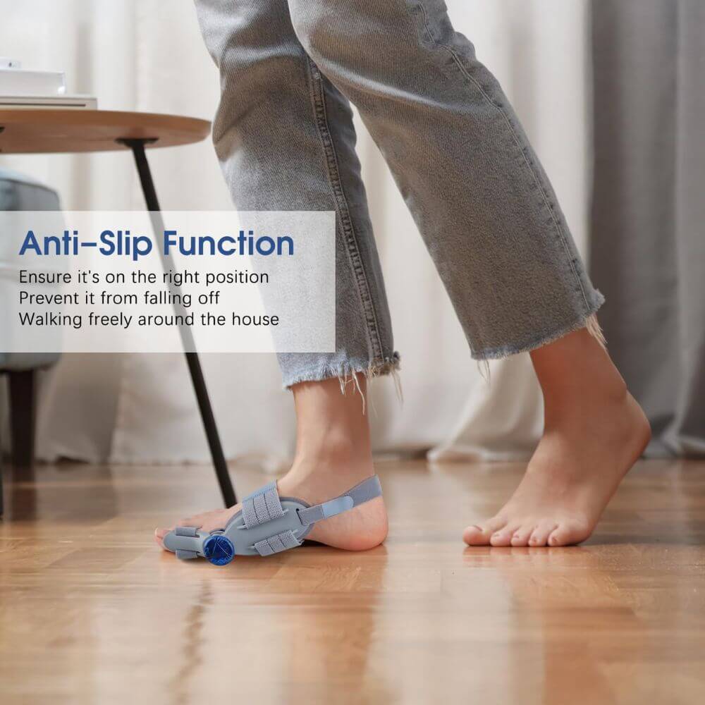 3D Bunion Corrector