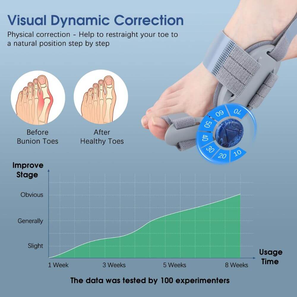 3D Bunion Corrector